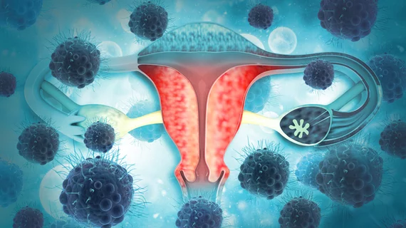 'Symptom triggered' testing can pick up early-stage aggressive ovarian cancer